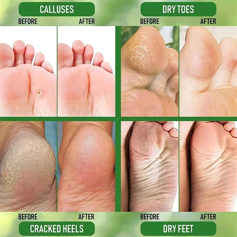 HerbaSoothe Anti-Crack Foot Cream