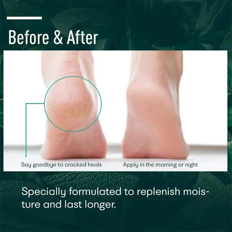 HerbaSoothe  Anti-Crack Foot Cream