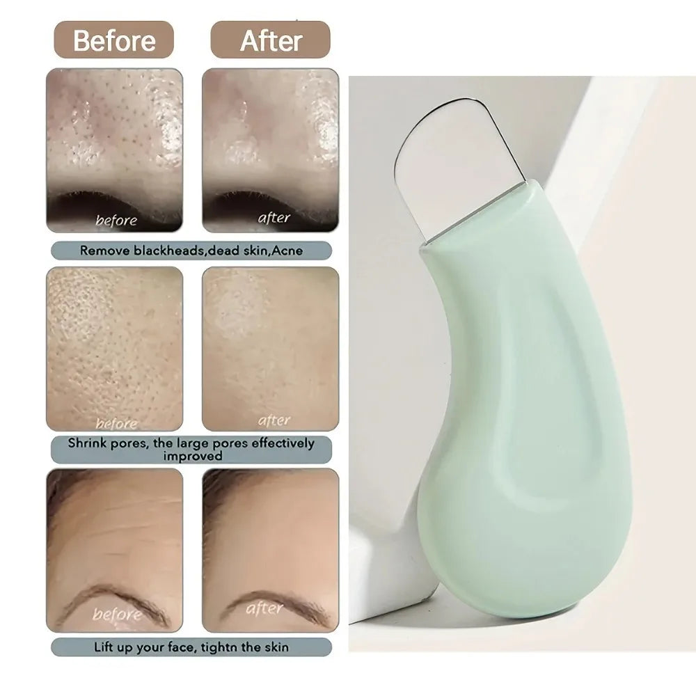 Auréa Skin Extractor